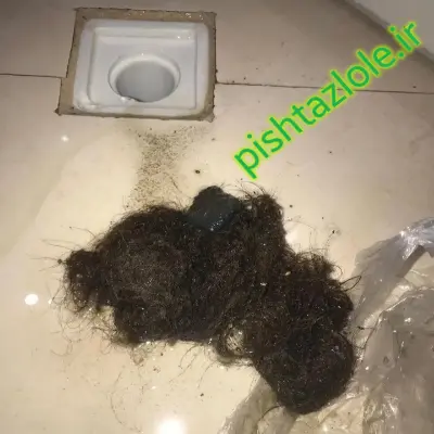 لوله بازکنی نکا