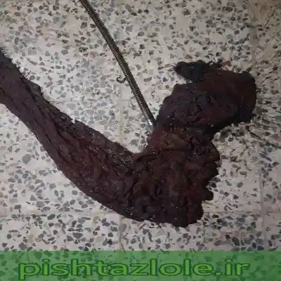 لوله بازکنی کیاشهر